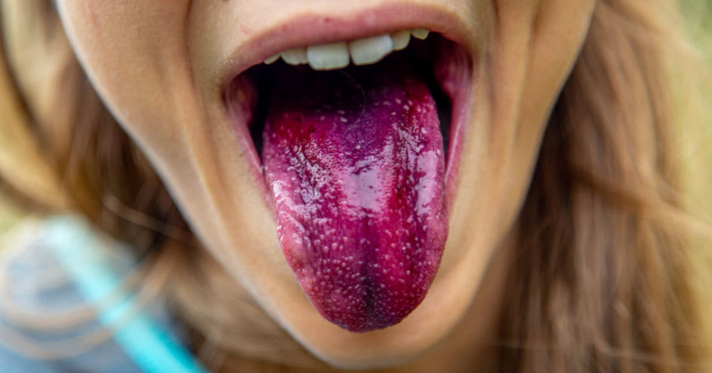 Why You Should Brush Your Tongue North View Dental